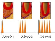 スタックモード