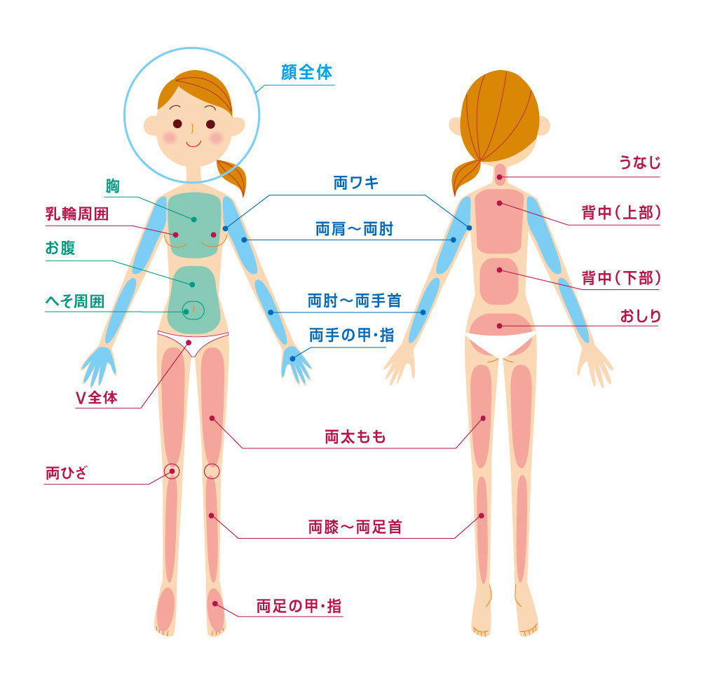 女性脱毛全体図