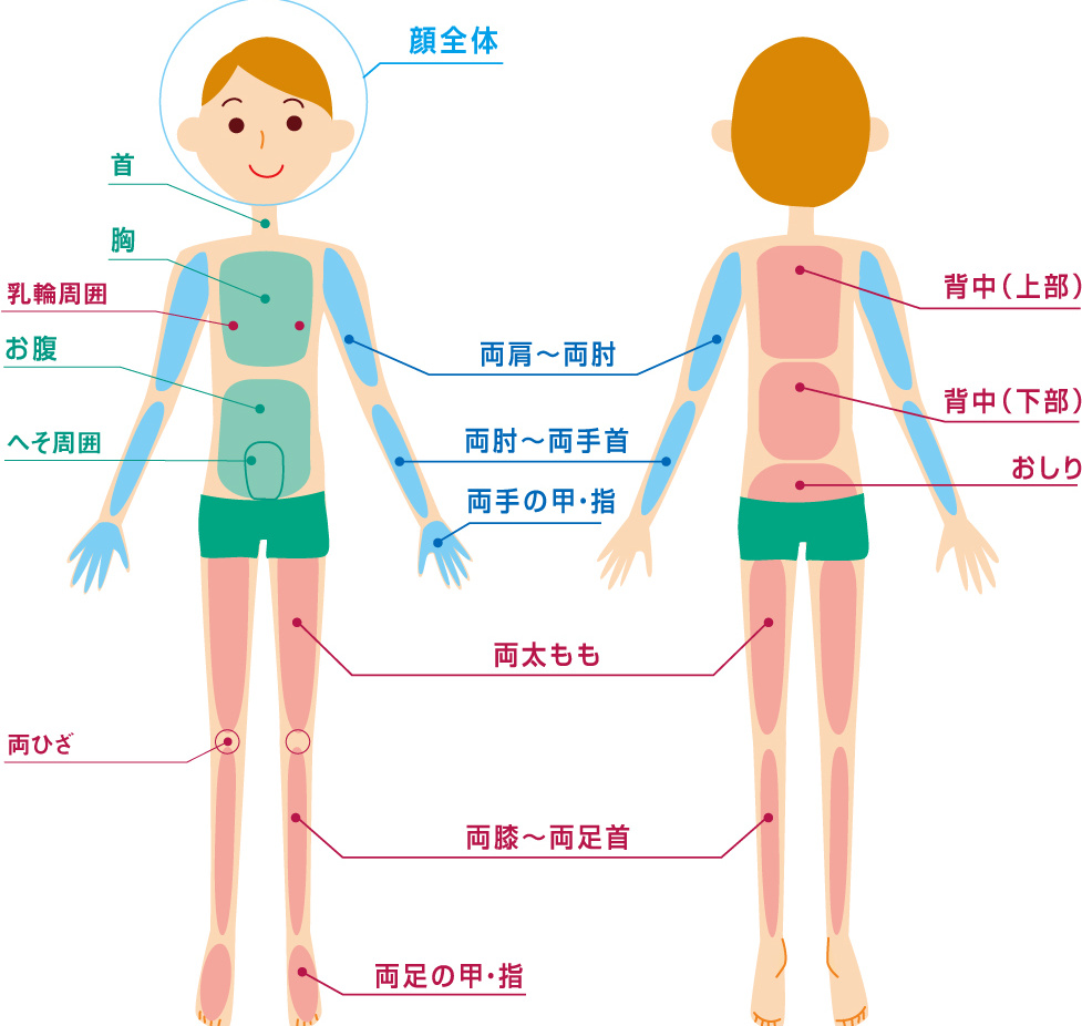 男性脱毛全体図