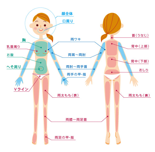 女性脱毛全体図