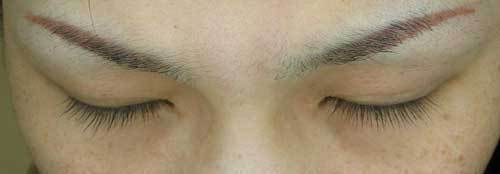 ラティース まつ毛 育毛 ルミガン グラッシュビスタ ビマトプロスト しむら皮膚科クリニック 新潟市 ラティース まつ毛 育毛 ルミガン グラッシュビスタ ビマトプロスト しむら皮膚科クリニック 新潟市