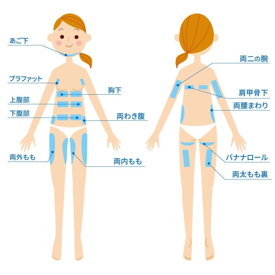 クールテック適応部位