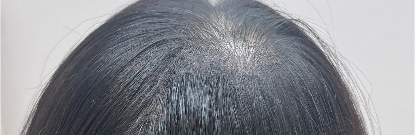 ヘア全体のアートメイク施術前