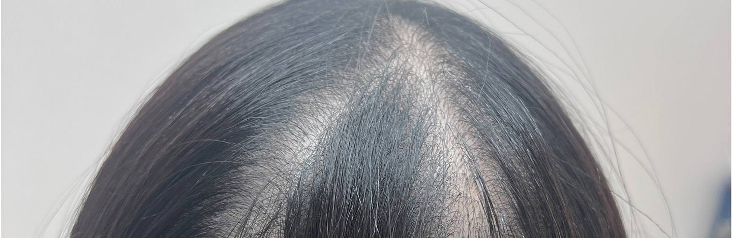 ヘア全体のアートメイク施術前