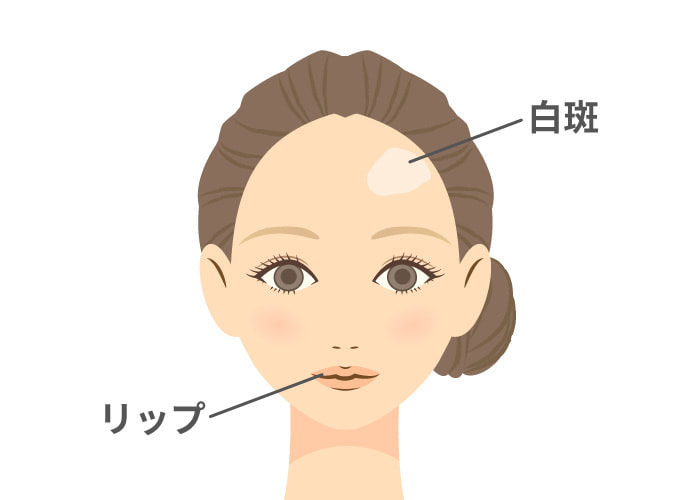 パラメディカル・アートメイク顔の施術箇所