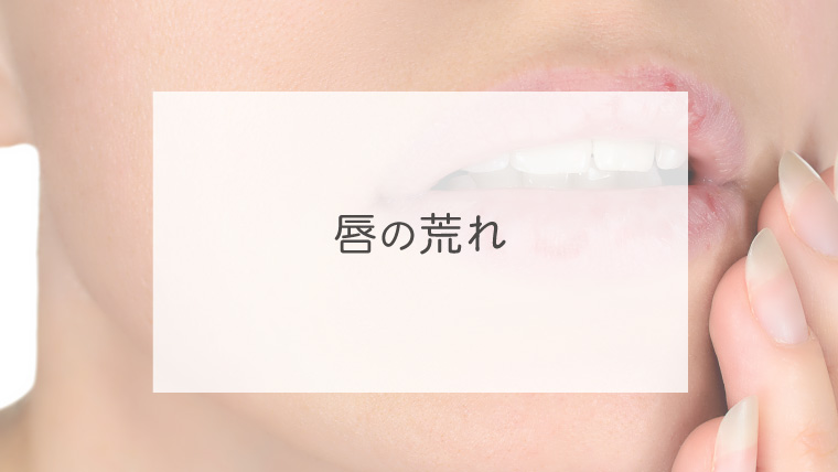 唇の荒れ