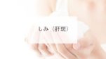 しみ（肝斑）
