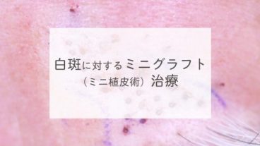 白斑に対するミニグラフト（ミニ植皮術）治療