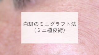 白斑のミニグラフト法（ミニ植皮術）
