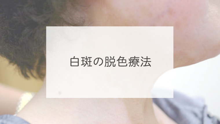 白斑の脱色療法