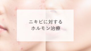 ニキビに対するホルモン治療