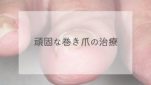 巻き爪の治療（ワイヤー法）