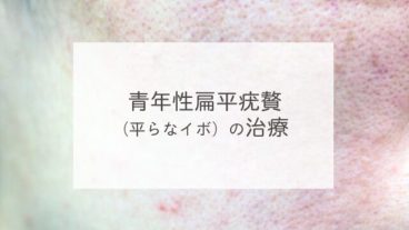 青年性扁平疣贅（平らなイボ）の治療