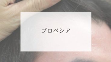 プロペシア