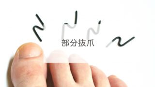 部分抜爪