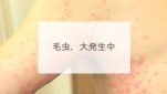 毛虫、大発生中