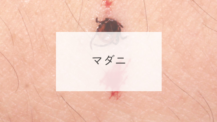 マダニ