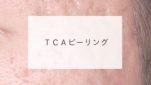 ＴＣＡピーリング