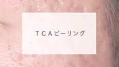 ＴＣＡピーリング