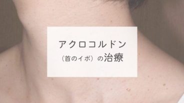 アクロコルドン（首のイボ）の治療