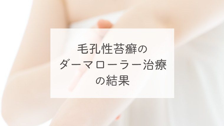 毛孔性苔癬のダーマローラー治療の結果