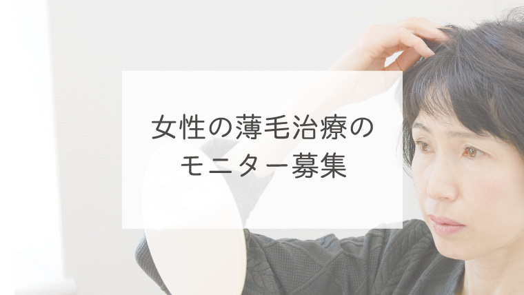 女性の薄毛治療のモニター募集