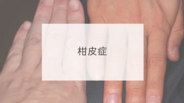 柑皮症