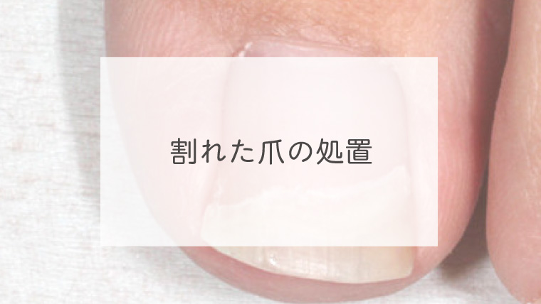 割れた爪の処置