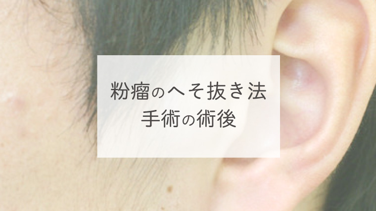 粉瘤のへそ抜き法手術の術後
