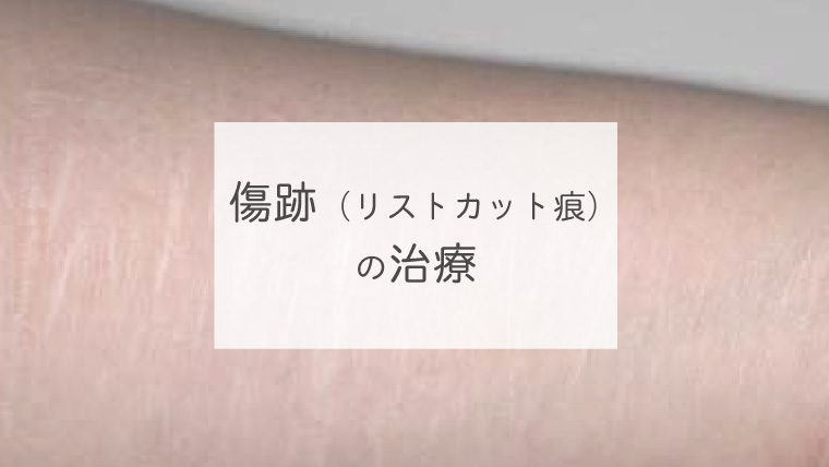 傷跡（リストカット痕）の治療