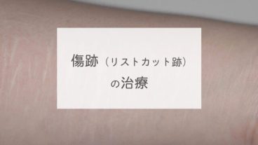 傷跡（リストカット跡）の治療