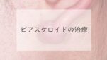 ピアスケロイドの治療