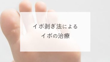 イボ剥ぎ法によるイボの治療