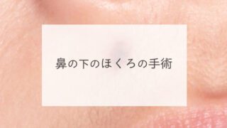 鼻の下のほくろの手術