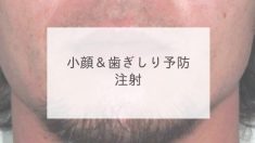 小顔＆歯ぎしり予防注射