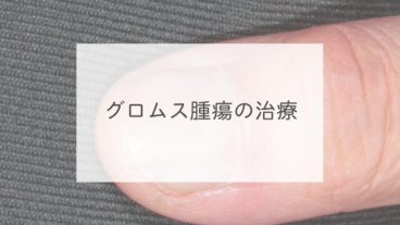 グロムス腫瘍の治療
