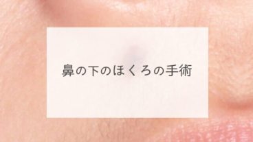 鼻の下のほくろの手術