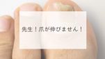 先生！爪が伸びません！