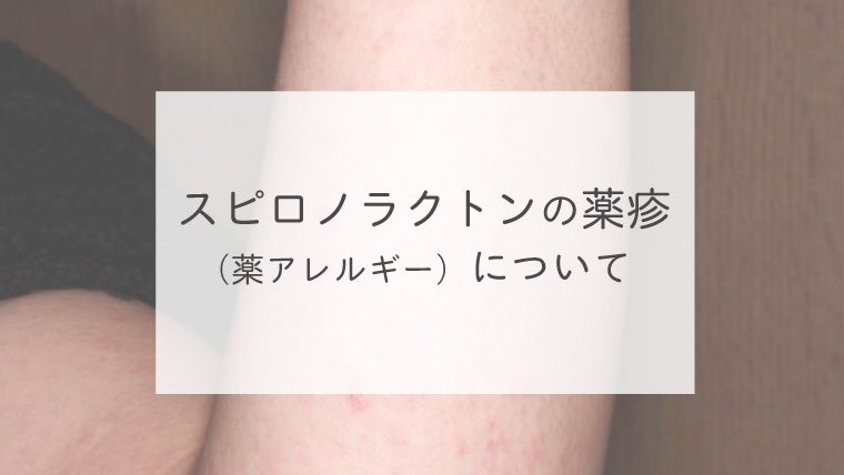 スピロノラクトンの薬疹（薬アレルギー）について