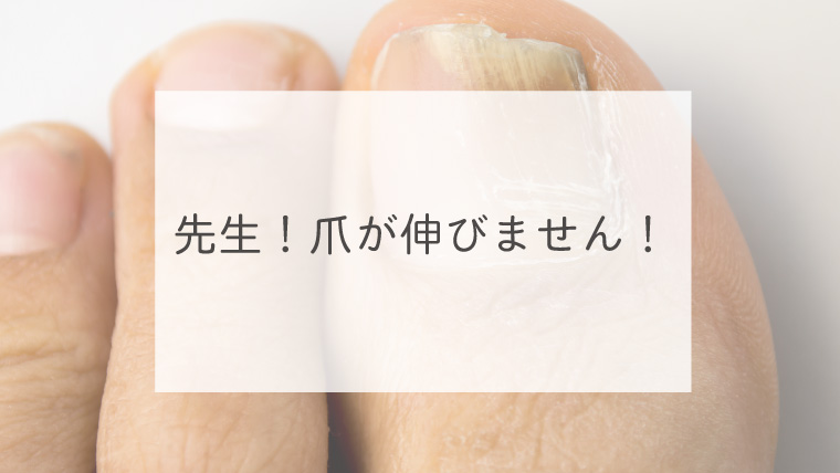 先生！爪が伸びません！