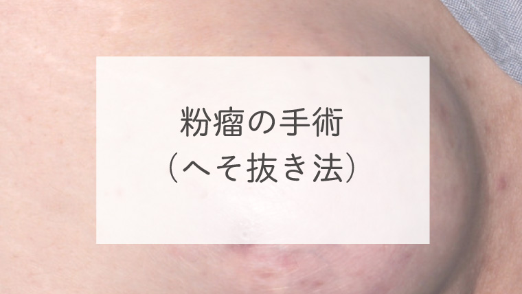 粉瘤の手術（へそ抜き法）