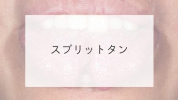 スプリットタン