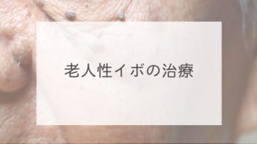 老人性イボの治療
