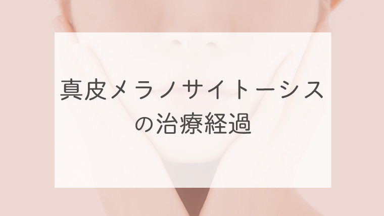 真皮メラノサイトーシスの治療経過