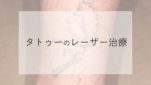 タトゥーのレーザー治療