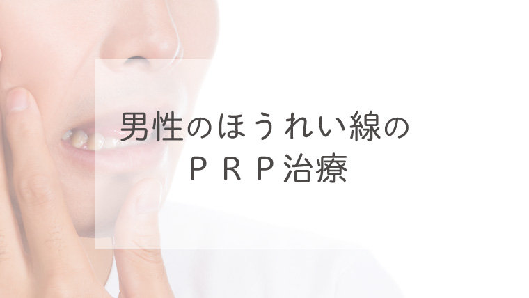 男性のほうれい線のＰＲＰ治療