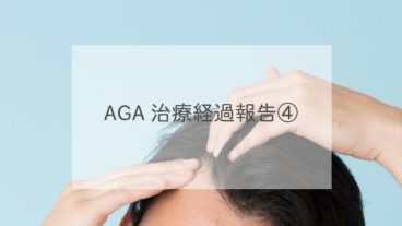 AGA治療経過報告④