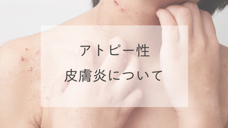 アトピー性皮膚炎について