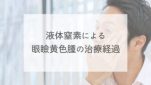 液体窒素による眼瞼黄色腫の治療経過